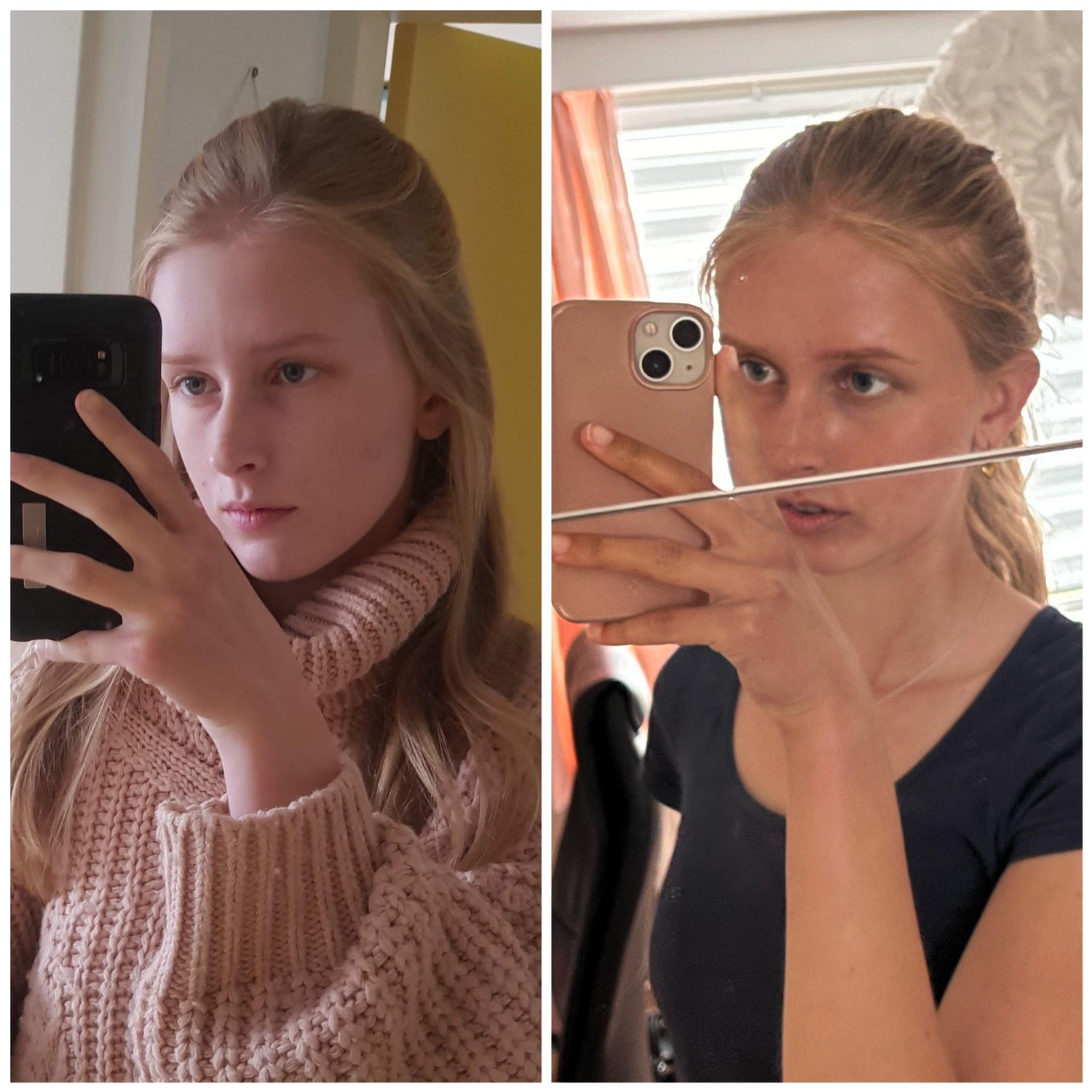 Before and After using Prestige Tans Tanning Nasal Spray